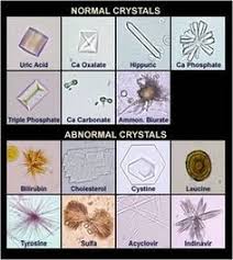 Crystals Medical Laboratory Scientist Medical Laboratory