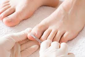 Image result for Toenail Removal