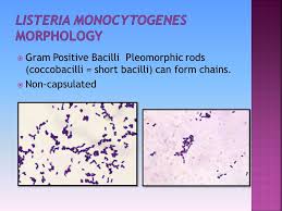 This pathogen is widely distributed in nature. Basmah Almaarik Lab 7 Listeria Monocytogenes Is The Only Species That Infect Humans Infection Most Common In Pregnant Women Still Birth Ppt Download