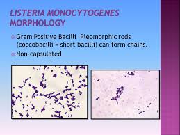 The gram stain result becomes variable as the culture ages. Basmah Almaarik Lab 7 Listeria Monocytogenes Is The Only Species That Infect Humans Infection Most Common In Pregnant Women Still Birth Ppt Download