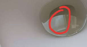 Was Ist Das In Meinem Urin Gesundheit Und Medizin Gesundheit Manner