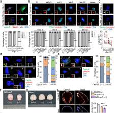 Check spelling or type a new query. Lack Of Adaptation To Centriolar Defects Leads To P53 Independent Microcephaly In The Absence Of Cep135 Biorxiv