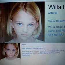 Did Janelle have a black eye in this last talk back? It totally looked like  it, but wasn't sure if it was a shadow