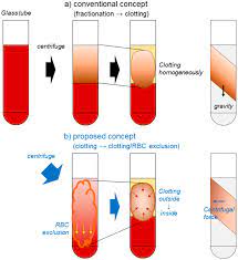 Лучшее from 26 october 2017. Ijms Free Full Text Quantitative Near Infrared Imaging Of Platelets In Platelet Rich Fibrin Prf Matrices Comparative Analysis Of Bio Prf Leukocyte Rich Prf Advanced Prf And Concentrated Growth Factors Html
