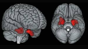 Adalet bakanlığı kura sonuçları açıklandı. Brain Scans Find Cte Linked Protein In Living Former Nfl Players Science Aaas