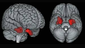 The images reveal abnormalities in both bone. Brain Scans Find Cte Linked Protein In Living Former Nfl Players Science Aaas