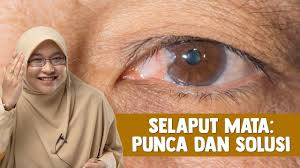 Dia juga akan membuat mata kucing mengalami lakrimasi, sobek, berselaput merah dan bola mata membesar (bengkak). Selaput Mata Punca Dan Solusi Youtube