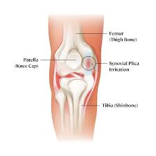 Image result for Patella Mobility Test