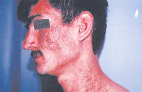 â€ı § Sayfalar T ĵrkderm-2006-2