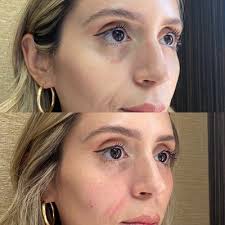 Stark Aesthetics, 416 N Bedford Dr, Ste 403, Beverly Hills, CA 90210, US