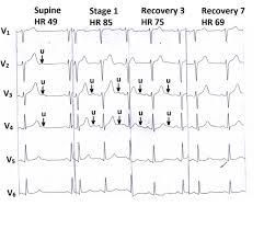 Image result for U Wave