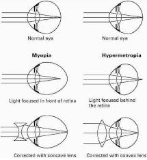 Pin By Julia Alejandra On Optometry School In 2020 Optometry Education Optician Training Basic Anatomy And Physiology