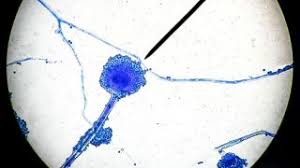 These infections are becoming increasingly common, yet survival remains very poor. Dd80zeyy Gmhqm