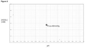 Davenport Diagram Wikipedia