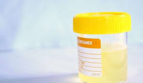 بيريسكوب مكثف إدراكا بول الحامل findlocal drivewayrepair com