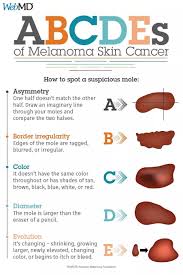 Pin On Health Tips