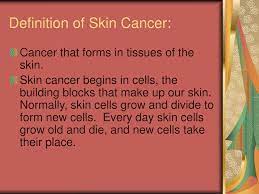 Skin cancer is the most common type of cancer in humans. Ppt Skin Cancer Powerpoint Presentation Free Download Id 683249