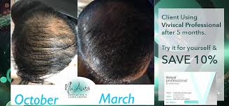 Every viviscal product, from viviscal shampoos and viviscal conditioners and viviscal tablets for hair growth, contains an innovative blend of hair nourishing ingredients, including: Viviscal Professional 30 Day Nu Aura Botox Clinic Botox Albuquerque Medical Spa And Laser Center