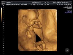 2d 3d 4d Ultrasound 15 Weeks 4 Days With Gender Reveal No Annoying Music Youtube