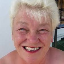 Has anyone dealt with valgus deformation after total knee replacement?