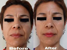 Dr. Anita Merani Bodymed Clinic in Mahatma Nagar,Nashik