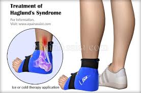 A full range of orthopedic services, from diagnosis to full recovery. Treatment Of Haglund S Syndrome Treatment Recovery Achilles Tendonitis Heel Treatment