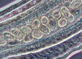 Image result for Whipworm