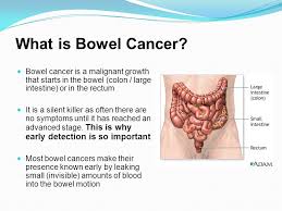 More than 90% of people with bowel cancer have 1 of the following combinations of symptoms: A Pharmacy Based Bowel Cancer Screening Program Did You Know Bowel Cancer Kills More Australians Each Year Than Breast Or Prostate Cancer Aihw Ppt Download