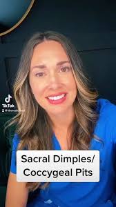 Let’s talk about sacral dimples/coccygeal pits! When to image, when to  refer, when to be concerned. Like and follow for more! #sacraldimple  #spinabifida #spinabifidaawareness #spinabifidaocculta ...