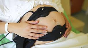 What Is Cardiotocography Ctg And Why Do I Need It Babycenter India