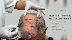 Best Hair Treatment for Hair Loss in India | Essence Aesthetic