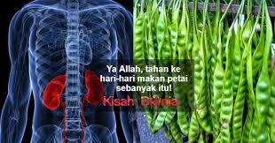 Jika penyebabnya tidak diketahui maka untuk menghilangkan sumber penyebabnya pun akan sulit. Petai Pulihkan Sakit Buah Pinggang Tapi Doktor Ini Sangkal Dan Kisah Dunia