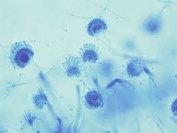 Usually the immune system can prevent any illness. Macroscopic Features Of Aspergillus Fumigatus Stain Lactophenole Download Scientific Diagram