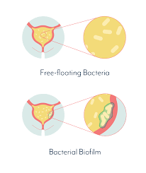 Learn about the causes of urinary tract infections. Chronic Urinary Tract Infection Vs Recurrent Uti Symptoms