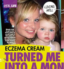Real life: 'Eczema cream turned me into a monster'