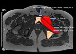 A variably thick muscular membrane called a diaphragm coccygeus and levator ani muscles the lower part of the this mri male pelvis axial cross sectional anatomy tool is absolutely free to use. Epos Trade