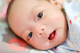 Babyakne Was Hilft Und Wie Muss Das Behandelt Werden