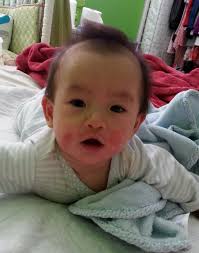 NAET Allergy Elimination — Aspire Health and Wellness