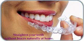 We did not find results for: How To Straighten Teeth Without Braces At Home In Hindi Teethwalls