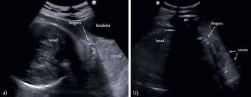 Image result for Compound Presentation