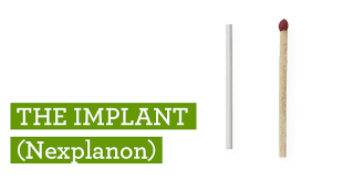 If you need to use it, you'll probably need to give it at least a few months trial. Implant Birth Control Method