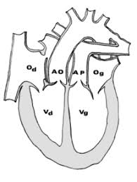 La transposition des gros vaisseaux est liée à l'absence de rotation à 180° de la voie de sortie du cœur pendant le développement embryonnaire, aboutissant à une position anormale des deux vaisseaux : Transposition Des Gros Vaisseaux Wikipedia