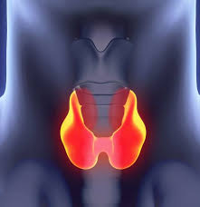 One of the ways aggressive thyroid cancers can become symptomatic is by the local invasion of surrounding structures, including the nerve that controls your vocal chord, says dr. Early Signs Of Medullary Thyroid Cancer And Common Symptoms