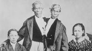 February 8, 2021 may 16, 2020 by dr. The Sex Lives Of Conjoined Twins The Atlantic