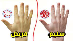 كثرة التبول و الألم و الحرقة هي من أعراض التهاب الجهاز البولي. Ø£Ø¹Ø±Ø§Ø¶ Ù…Ù† Ø´Ø±Ø¨ Ø¯Ù… Ø§Ù„Ø­ÙŠØ¶ Ù‡Ù„ Ù‚Ù„Ø© Ø¯Ù… Ø§Ù„Ø¯ÙˆØ±Ø© ÙŠØ¯Ù„ Ø¹Ù„Ù‰ Ø¶Ø¹Ù Ø§Ù„ØªØ¨ÙˆÙŠØ¶ ÙˆÙ…Ø§ Ù‡ÙŠ Ø§Ù„ÙƒÙ…ÙŠØ©