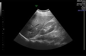 Image result for Ultrasound