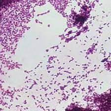 Monocytogenes found in this aneurysm, see gram stain (above). Listeria Monocytogenes Gram Stain As Seen In A Light Microscope Download Scientific Diagram