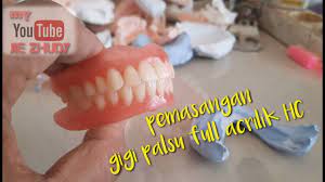 Ready to learn gigi palsu and 16 other words for perawatan mulut in american english? Pemasangan Gigi Palsu Full Acrilik Hc Dengan Harga Terjangkau Youtube