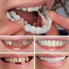 Magic Teeth Brace Perfect Smile Perfect Teeth Teeth Braces