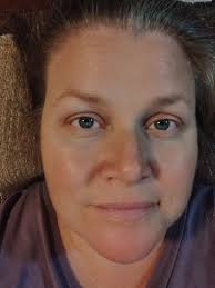 Embracing self love and imperfections